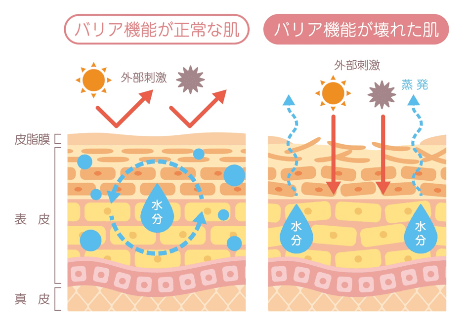 空気の乾燥による肌への影響